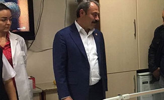 AKP’li vekil kaza yaptı