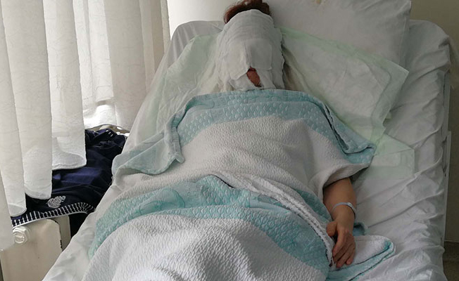 Eski sevgili dehşeti! Yüzüne kimyasal madde döktü