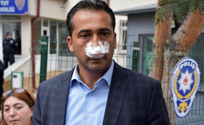 Hesaba itiraz etti, ailesinin yanında dayak yedi...