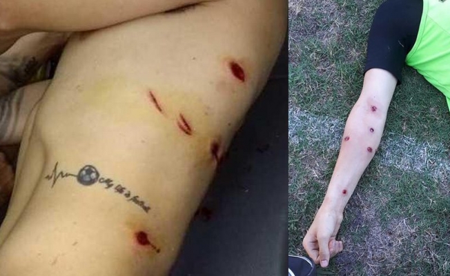 Polis futbolculara plastik mermi sıktı