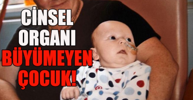 Oğlunun cinsel organının büyümediğini nasıl fark etti?