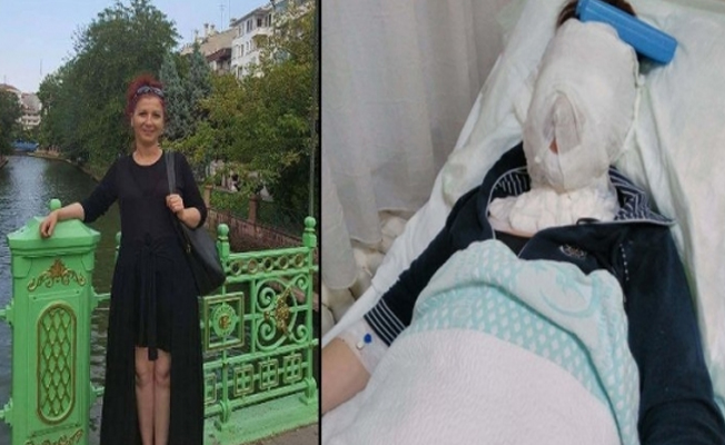 Yüzüne kimyasal dökülen kadın: Devlet koruma talebimi reddetti