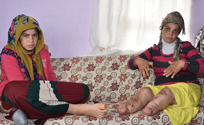 'Önce ayaklarımız sonra ellerimiz eriyor'