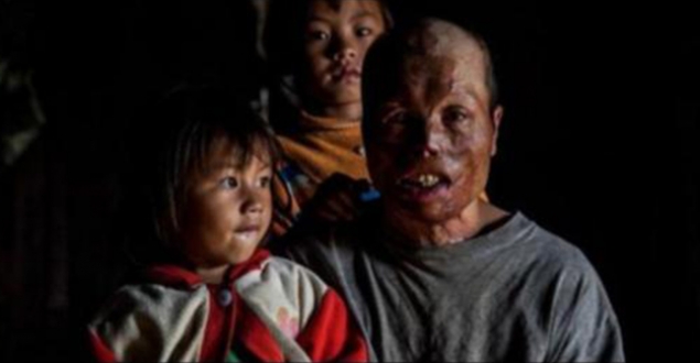 Obama'dan Laos'a 90 milyon dolar
