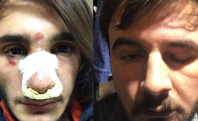 Gençlere polis merkezinde ‘palyaço’ dayağı