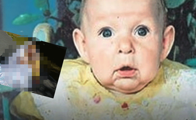 Babası doğduktan sonra yüzünü görünce terk etti! Şimdi ise...
