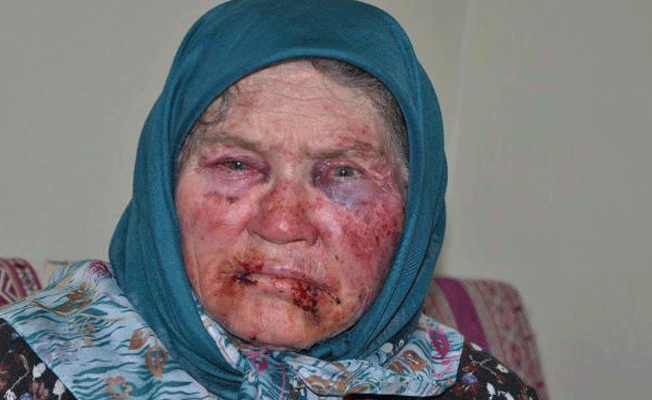 75 yaşındaki kadına evinde gaspçı dayağı