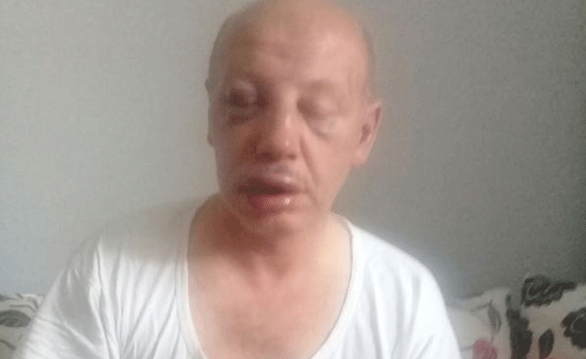 Para üstü için taksiciyi bayıltana kadar dövdüler