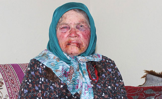 Yaşlı kadını bu hale getirenler şoke etti!