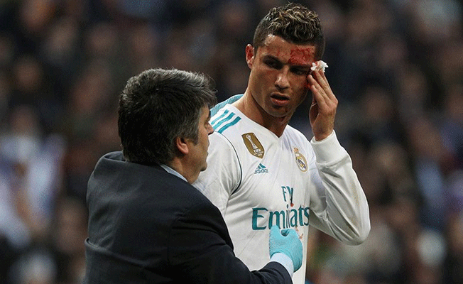 Ronaldo kanlar içinde kaldı!