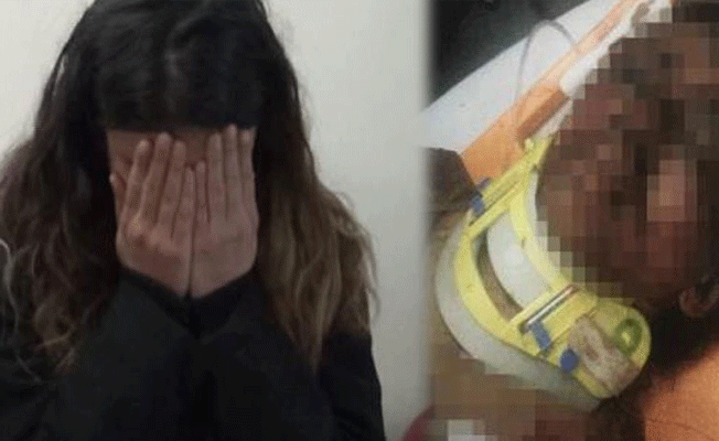 Eşini tornovida ile yaralayan caniden skandal savunma