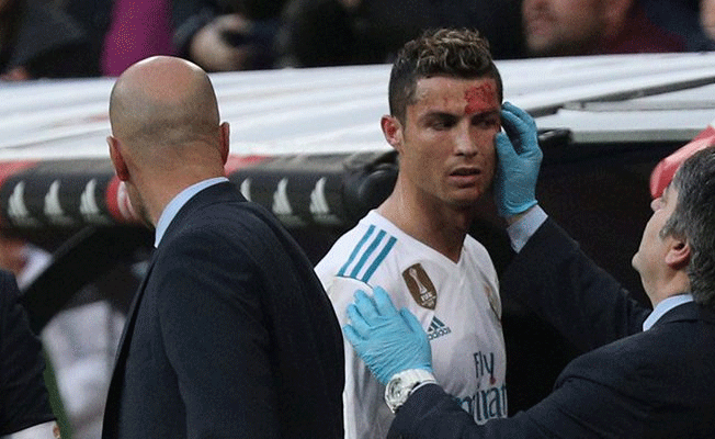 İspanya basını kanlar içinde kalan Ronaldo'yu Tİ'ye aldı