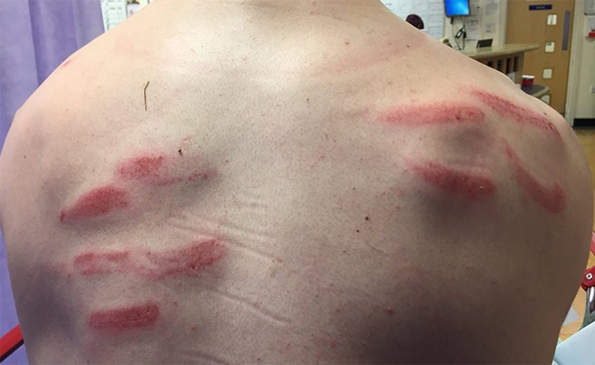Kaleci krampon darbesi aldı... Fotoğrafını sosyal medyada paylaştı