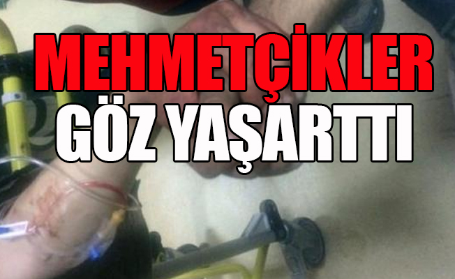 Yaralanan Mehmetçikler el ele tutuşarak birbirlerine moral verdiler