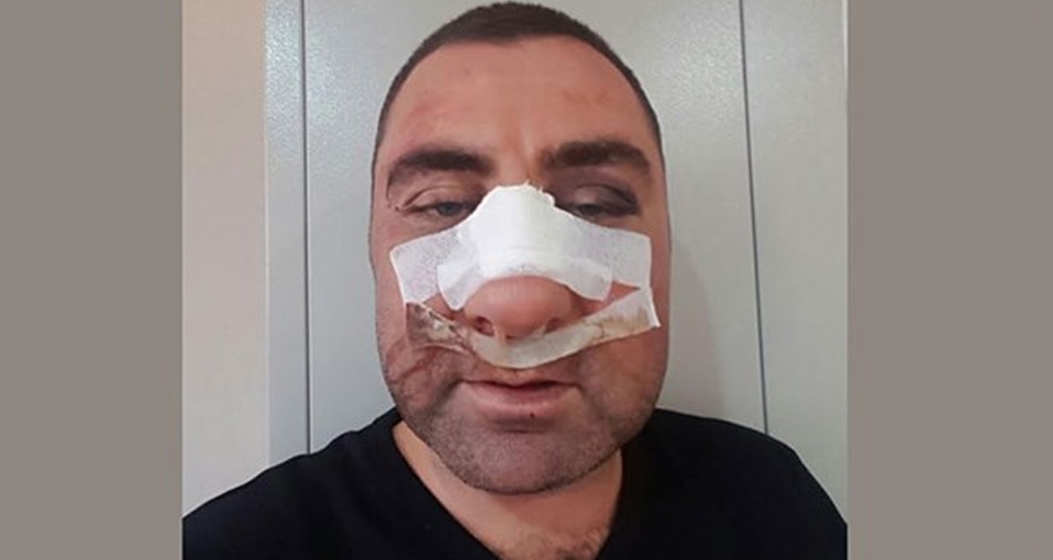 Dairesini almak istedikleri avukata 8 saat işkence yaptılar