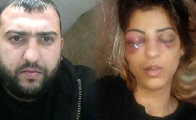 Adana'da skandal: Sevgilisinin elini kırdı, eşini bu hale getirdi
