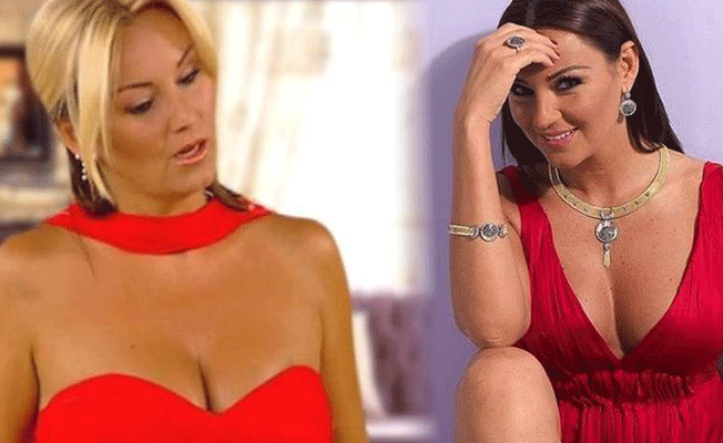 Pınar Altuğ botoks kurbanı oldu