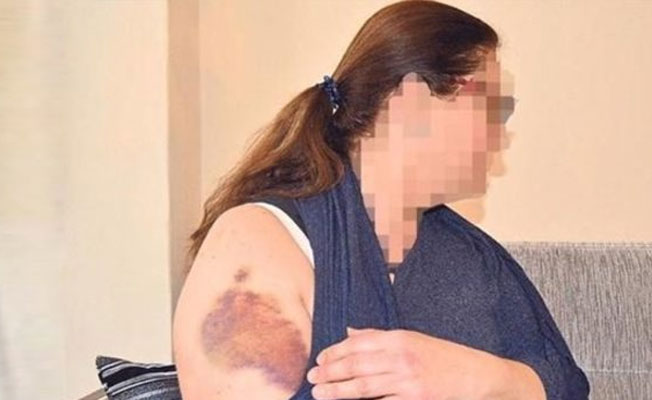 Skandal: Patronun sevgilisinden dayak! Sebebi ise...