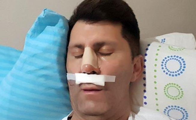 Oyuncu Ahmet Çevik kaza geçirdi!