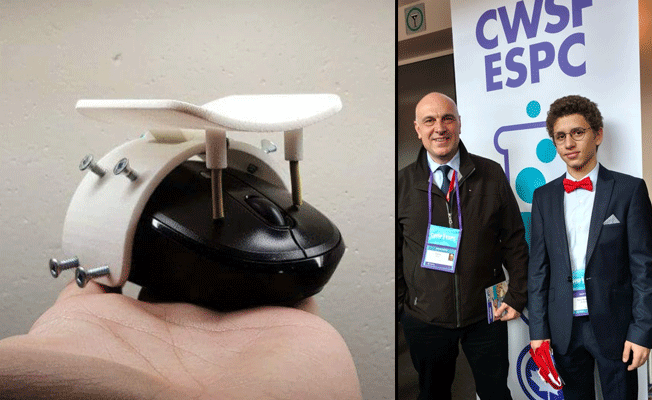 Türk genci, eli olmayanlar için mouse geliştirdi