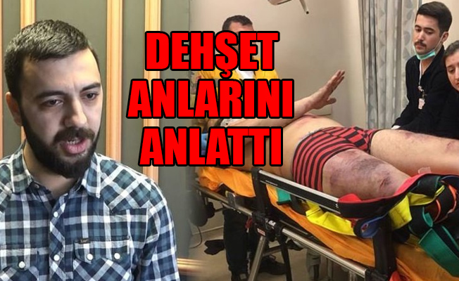 Metroda yürüyen merdivenin içerisine düşmüştü...