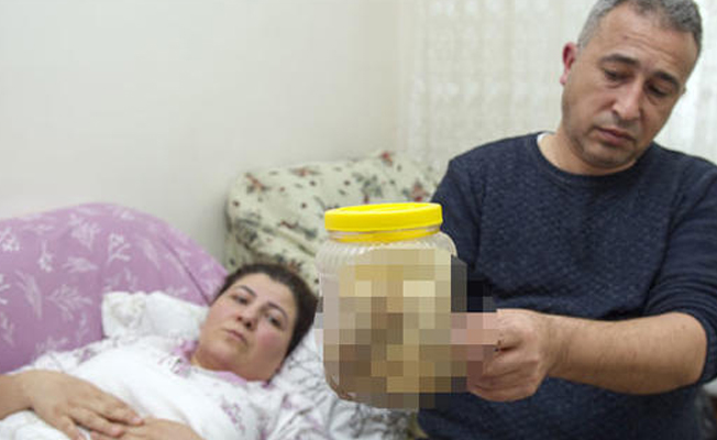 Kist olduğu sanılarak ameliyata alındı, karnından çıkan şoke etti