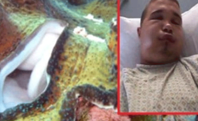 Cinsel organını istiridyeye sokunca hastanelik oldu
