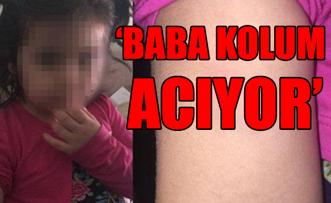 Gündüz Bakım Evi'nde yine bir skandal!