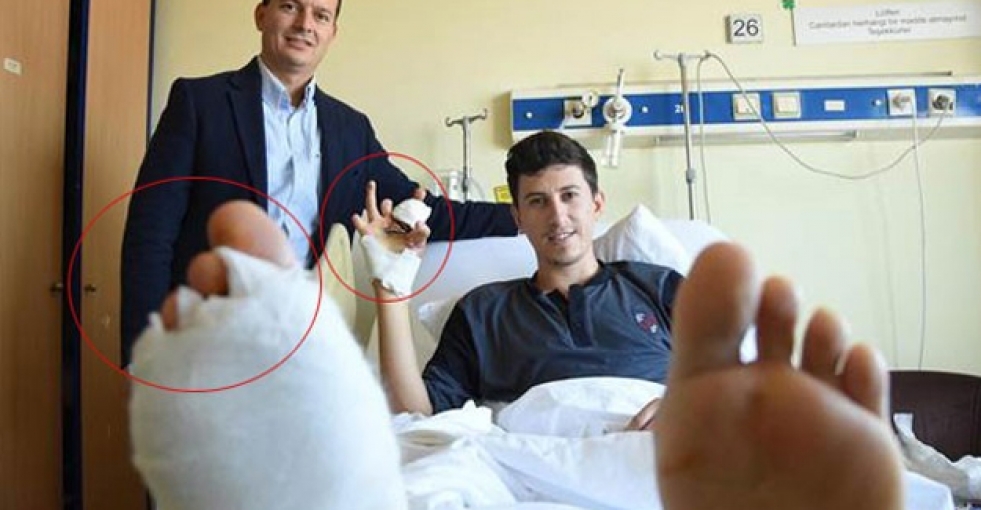 Ayak parmakları eline dikildi