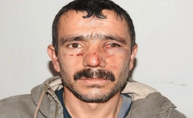 Polisten skandal sözler: Bir Alevinin kafasını kırdım şimdi de senin kafanı kıracağım!