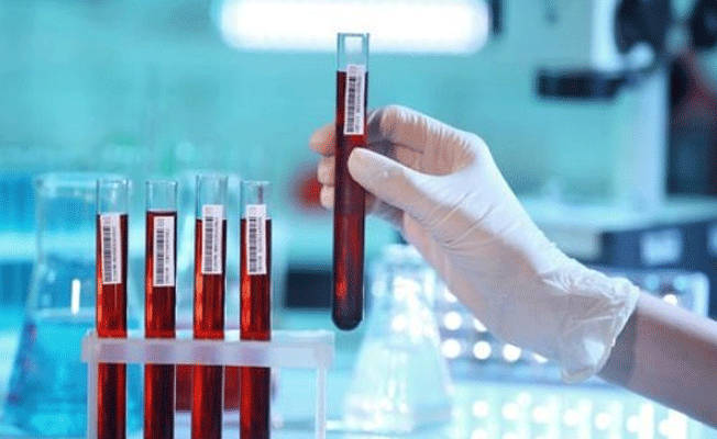 Bu testlere sadece büyüklerin ihtiyacı var sanmayın