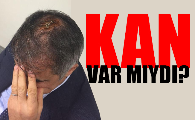 Şenol Güneş'e müdahale eden doktor konuştu