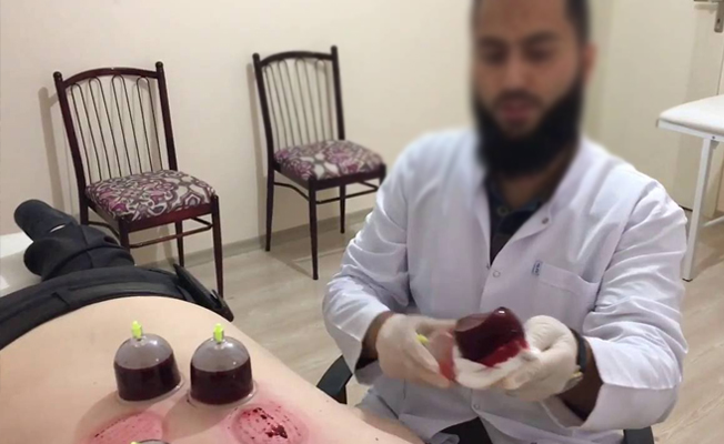 Hacamata SGK desteği