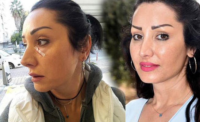 Patatesi değiştir dedi... Garson dehşet saçtı