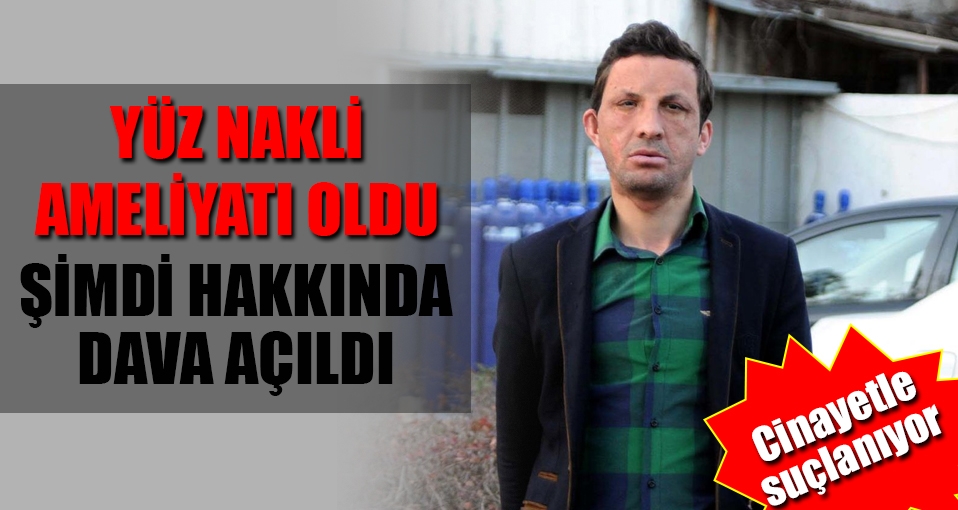 Yüz nakilli Uğur Acar'a cinayet davası