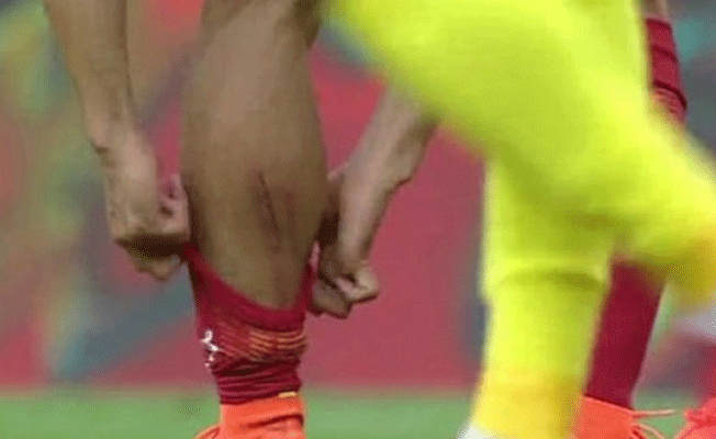Galatasaraylı yıldızın görüntüsü şoke etti
