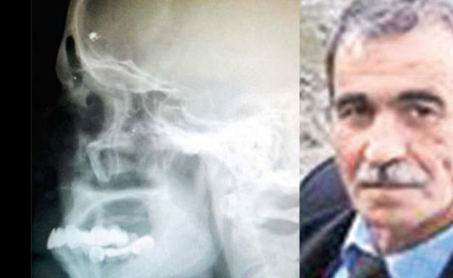Kafasındaki mermi 40 yıl sonra fark edildi... Sorduğu soru şaşkınlık yarattı
