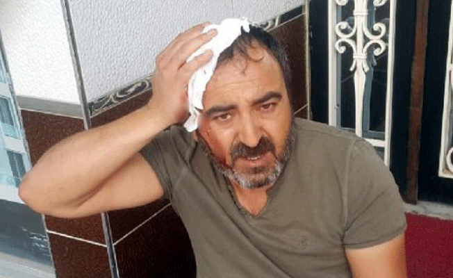 Aydın'da yerel gazete sahibine sopalı saldırı