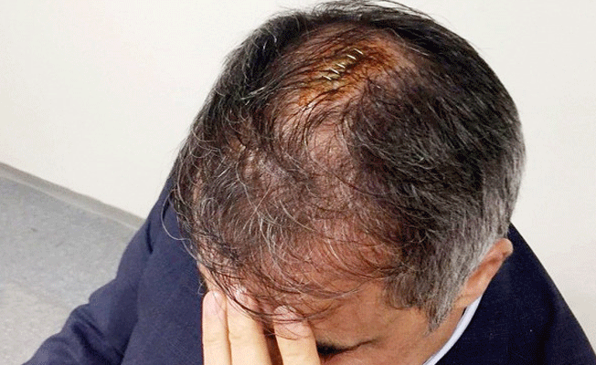 Şenol Güneş’e çakmak atan şüpheli hakkında karar