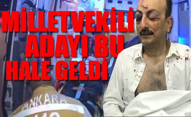 Ankara'da pankart kavgası
