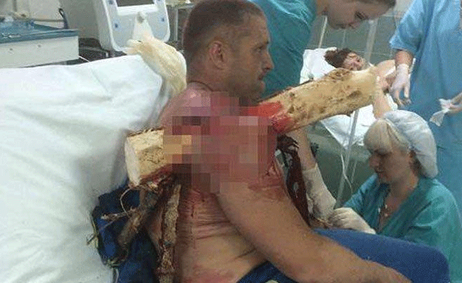 Hastaneye böyle getirildi… Doktorlar bile şok oldu