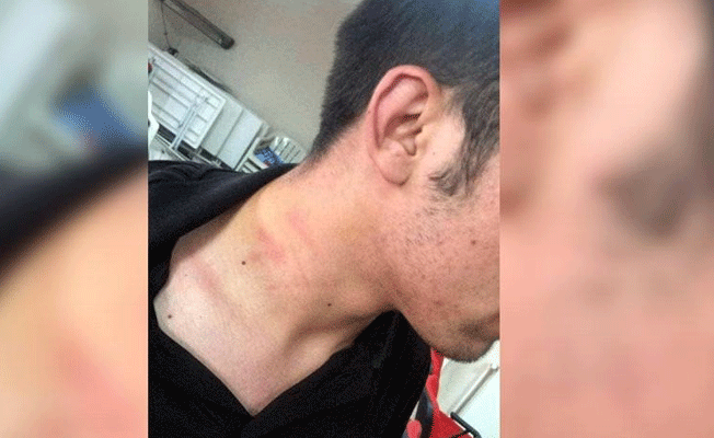 AKP’li Özçelik CHP’li gencin boğazını sıktı, daha sonra özür diledi