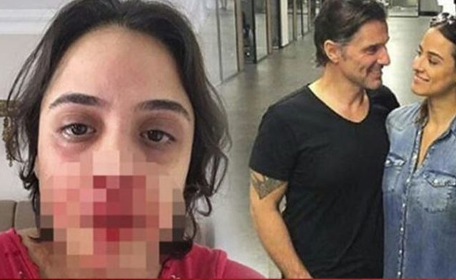 Nişanlısına şiddet uygulayan Hazım Körmükçü'den flaş açıklama