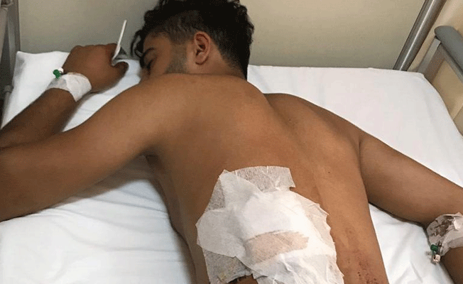 Seçim çalışması yürüten yurttaşlara saldırı: 2 yaralı