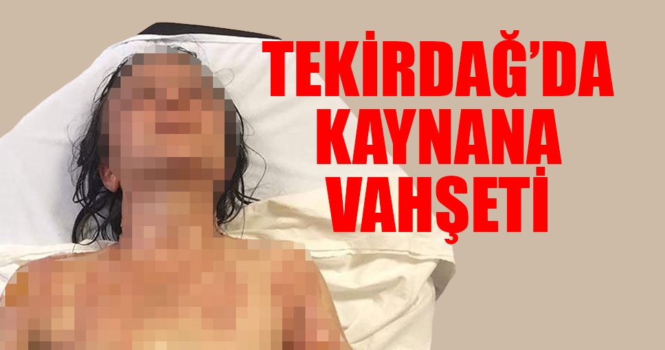 Uyuyan gelinin yüzüne kızgın yağ döktü