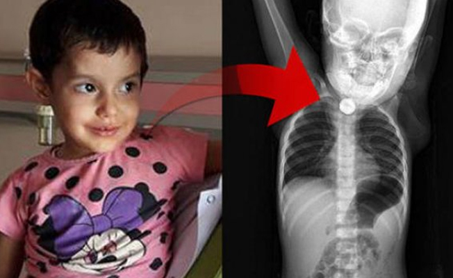 1,5 yaşındaki Berfin bebek korkuttu