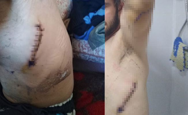 Kırmızı ışıkta, baltalı bıçaklı saldırı!