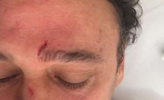 Bir saldırı da İstanbul'dan: Doktor kafa travması geçirdi