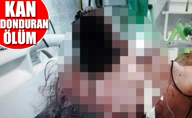 Tuvalet fırçası gözüne girdi