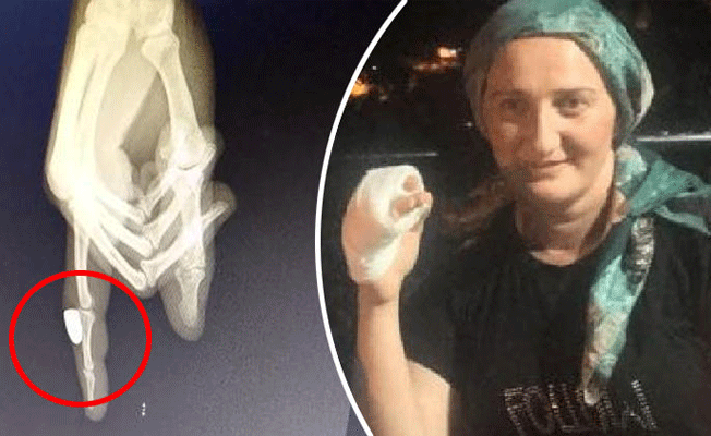 Balkonda otururken parmağına kurşun isabet etti